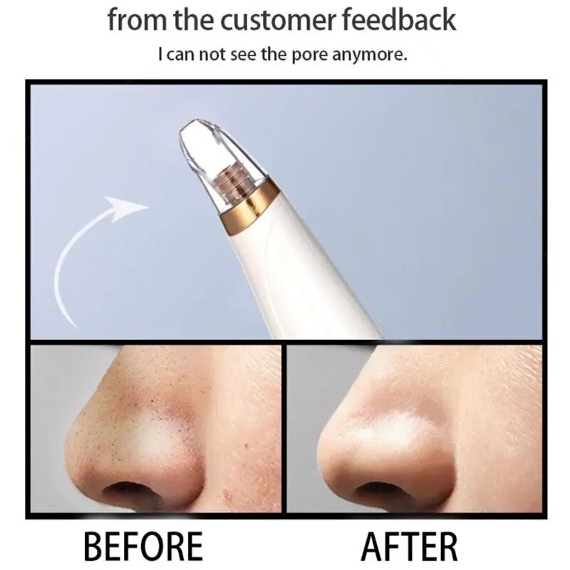 Vacuum Suction Electric Blackhead Remover Face Skin Care Device